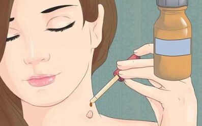 How to get rid of papillomas people's treatment
