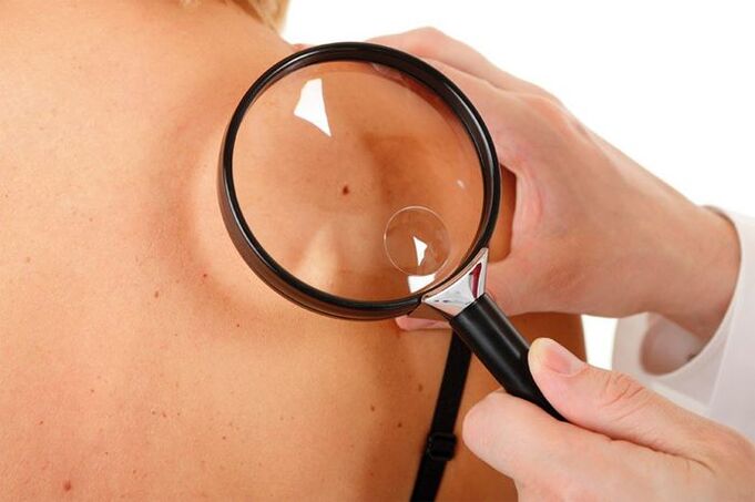 Examination of a patient with HPV
